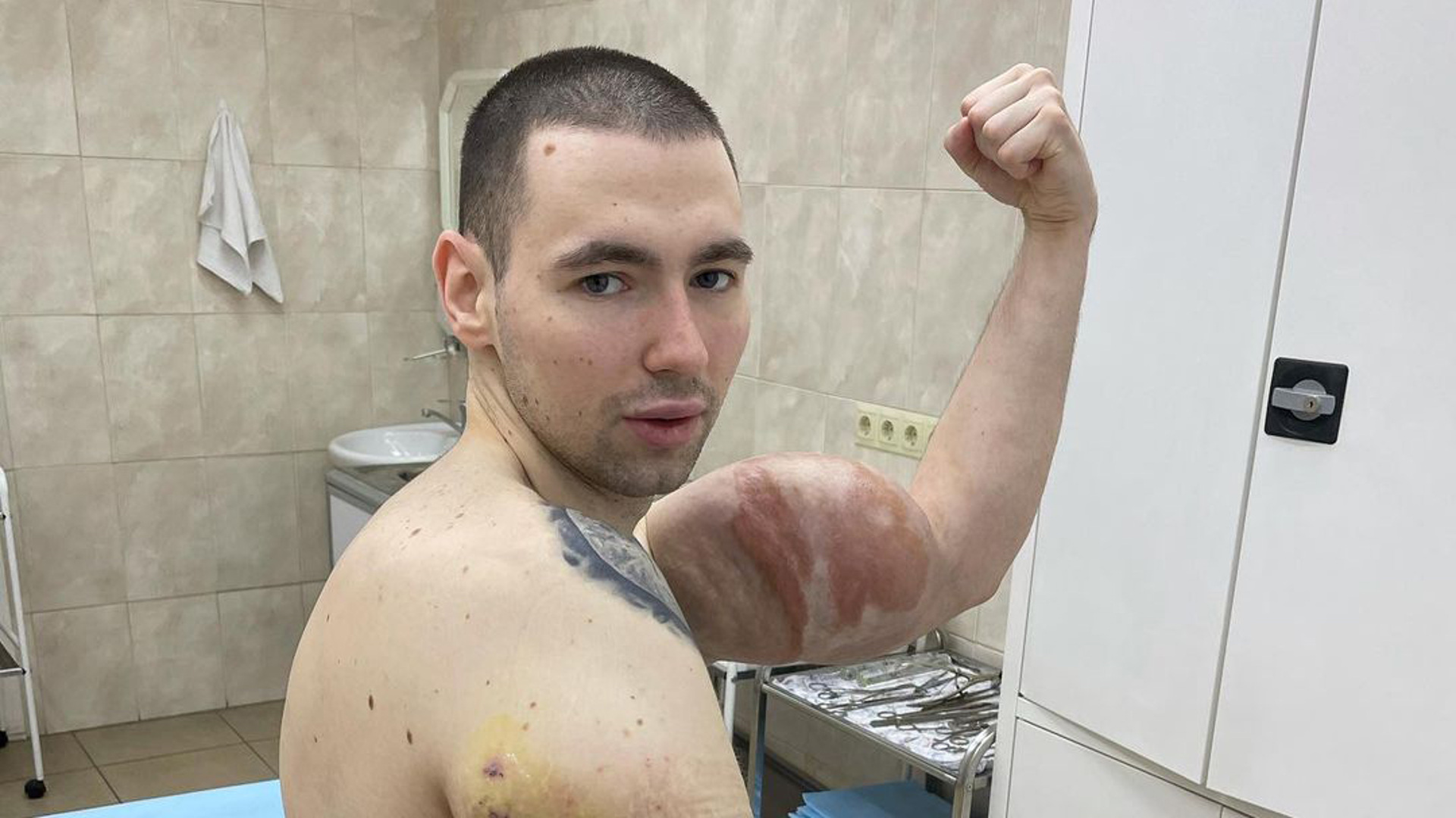 Изменился до неузнаваемости: как сейчас выглядит 