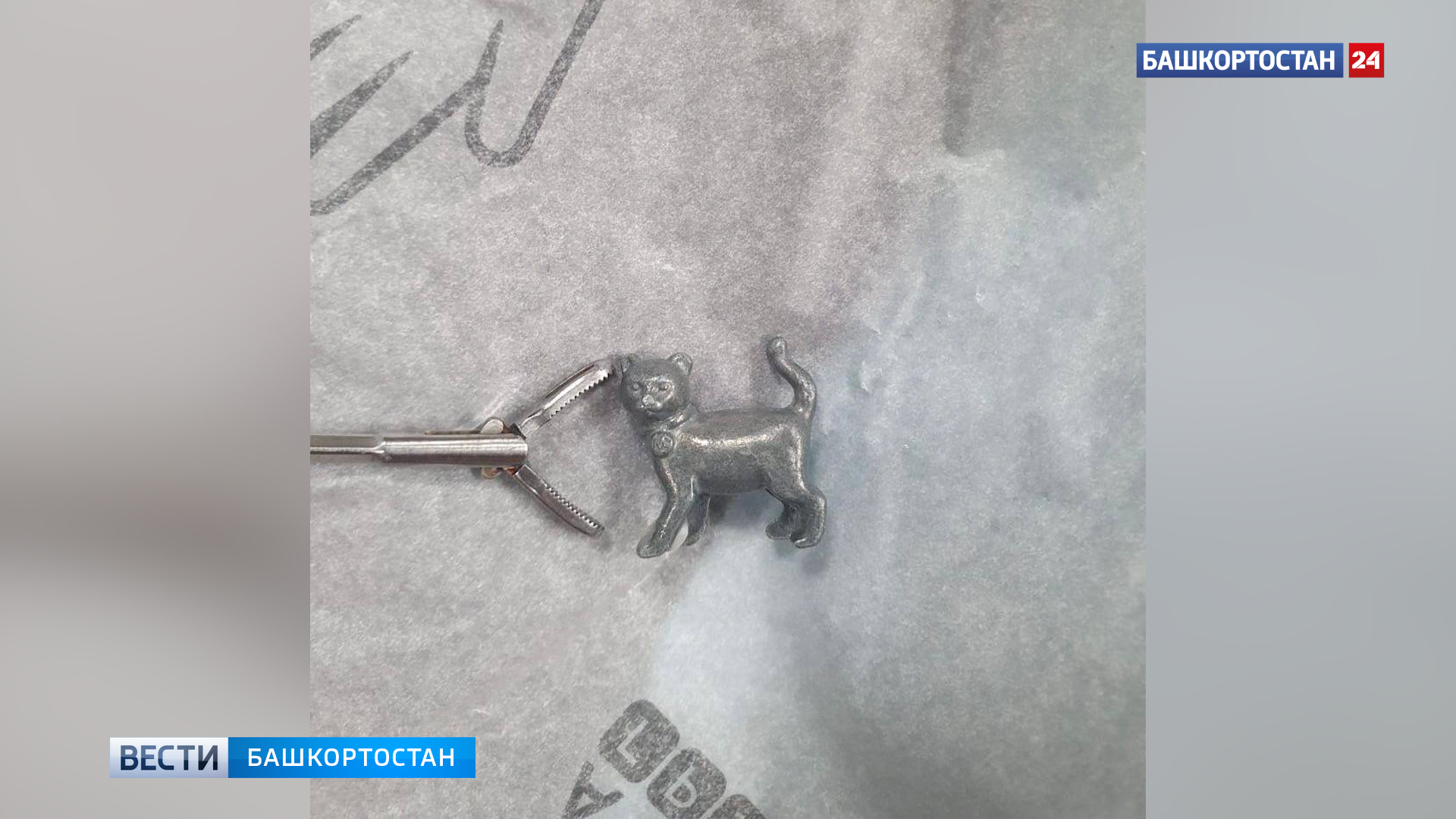 В Уфе хирурги спасли 3-летнюю девочку, которая проглотила металлическую игрушку в форме кошки | 1