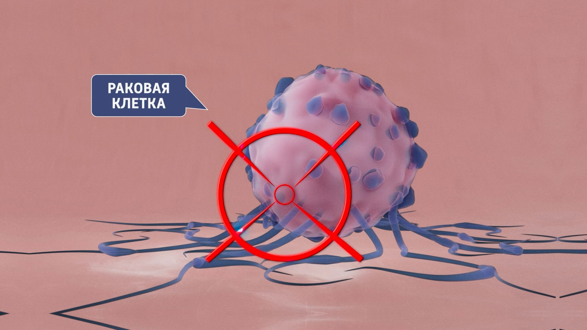 Ксензенко рак чего. Ксензенко рак чего