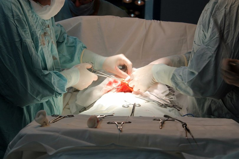 В Уфе врачи выполнили юбилейную пересадку печени женщине с риском кровотечения