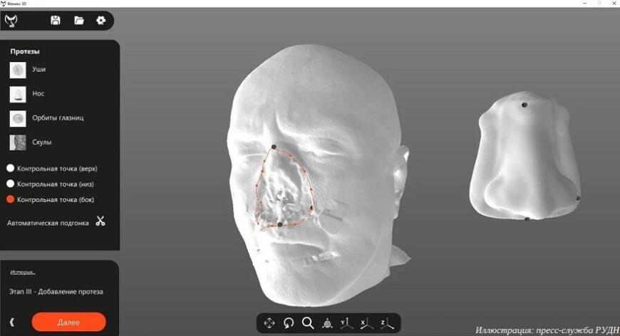 Ученые РУДН создали программу для 3D-моделирования лицевых протезов