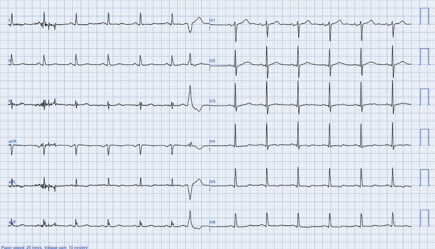 qirtli45d3z2cjurt6eywpktu0cfk692tc2vr