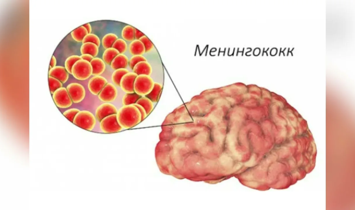 Менингит презентация казакша