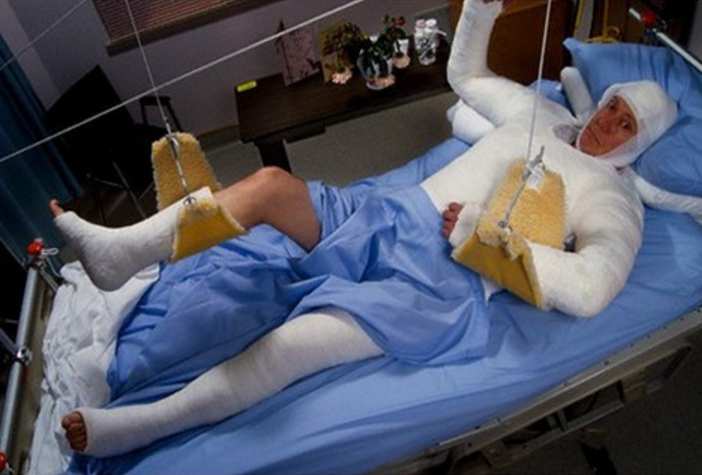 Страховщик рассказал о необычных причинах травм россиян