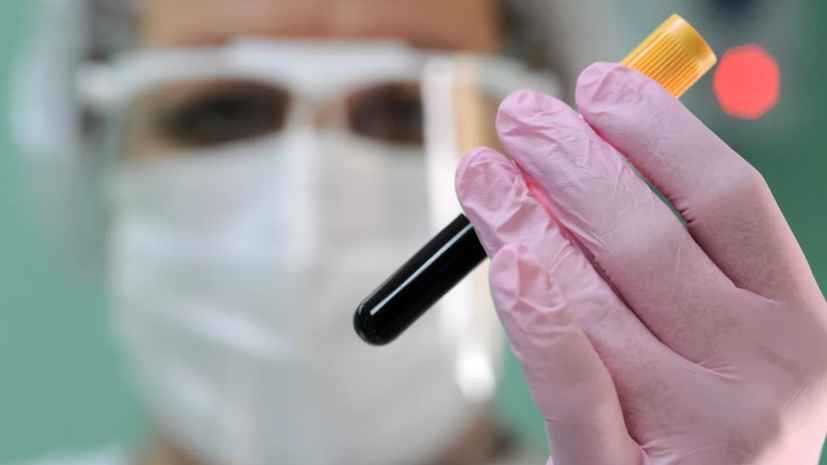 Вирусолог объяснил значение выявления случая двухлетнего заражения ковидом