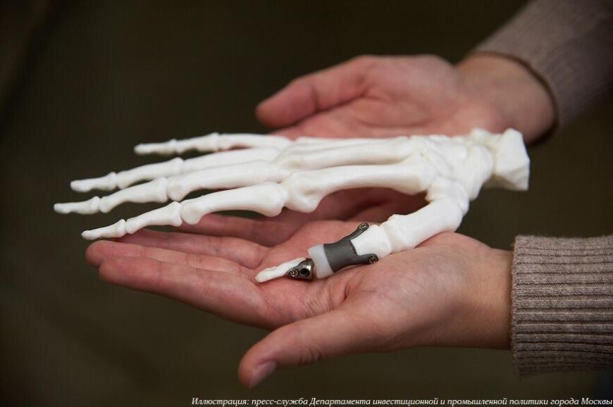 Столичные предприятия развивают применение аддитивных технологий в медицине и протезировании