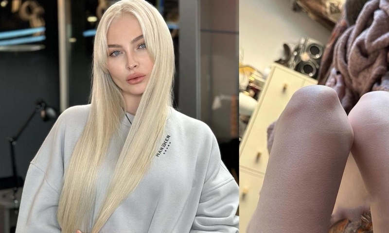 Алена Шишкова впервые рассказала о болезни, из-за которой ее внешность кардинально менялась много раз 