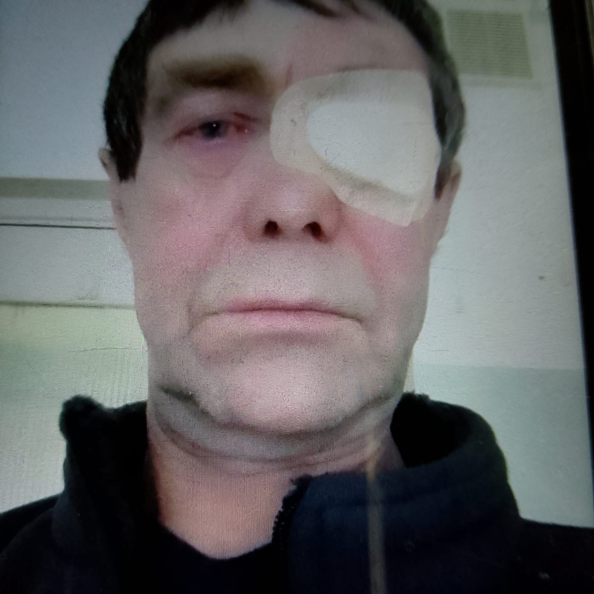 Иван Курилов после операции.