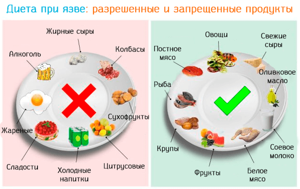 Болезни пищи. Рацион питания при язве желудка. Режим питания при язвенной болезни желудка. Лечебная диета 1 при язвенной болезни желудка. Продукты питания разрешенные при язвенной болезни желудка.