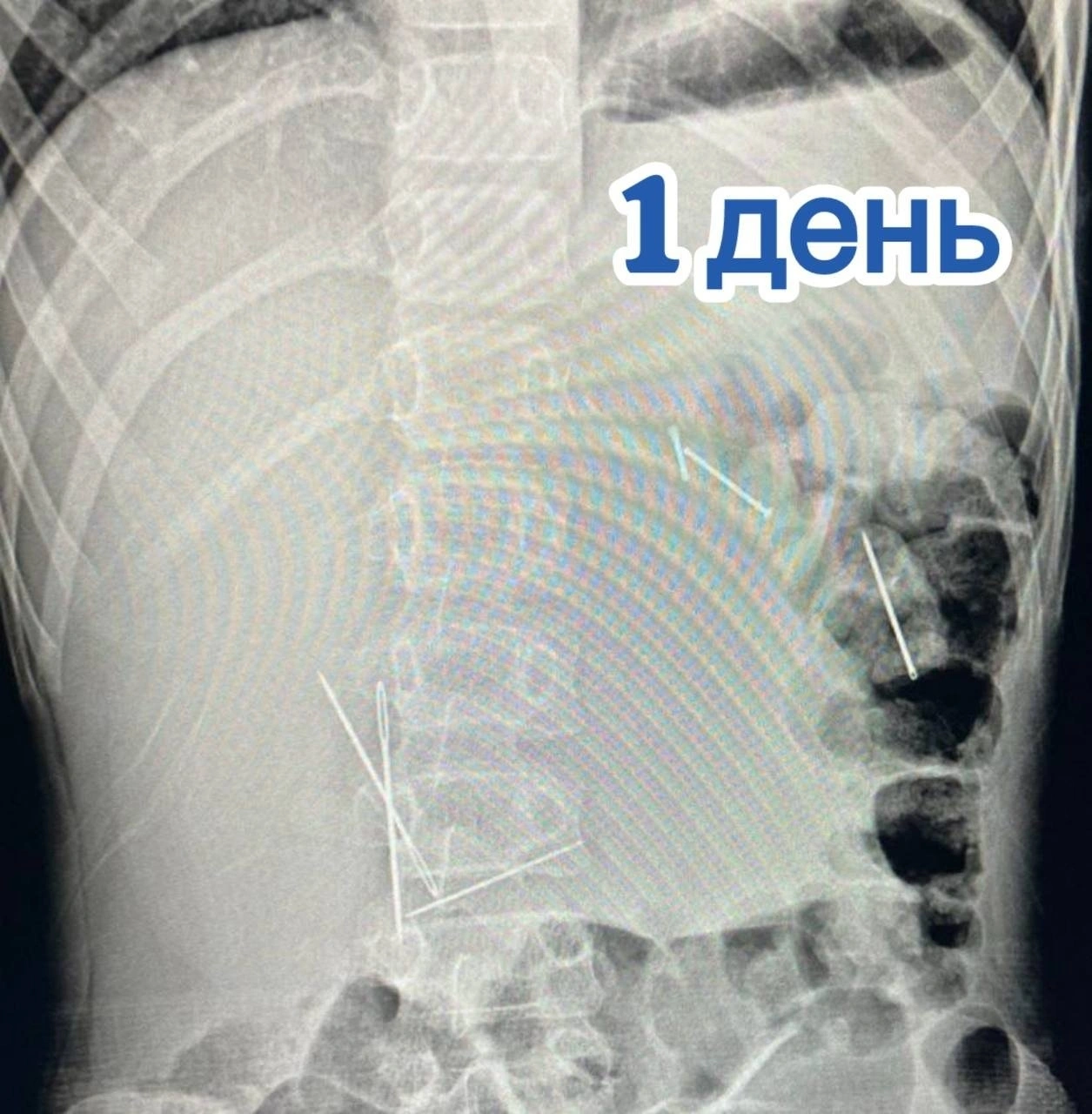 Телеграм-канал Клиники доктора Рошаля