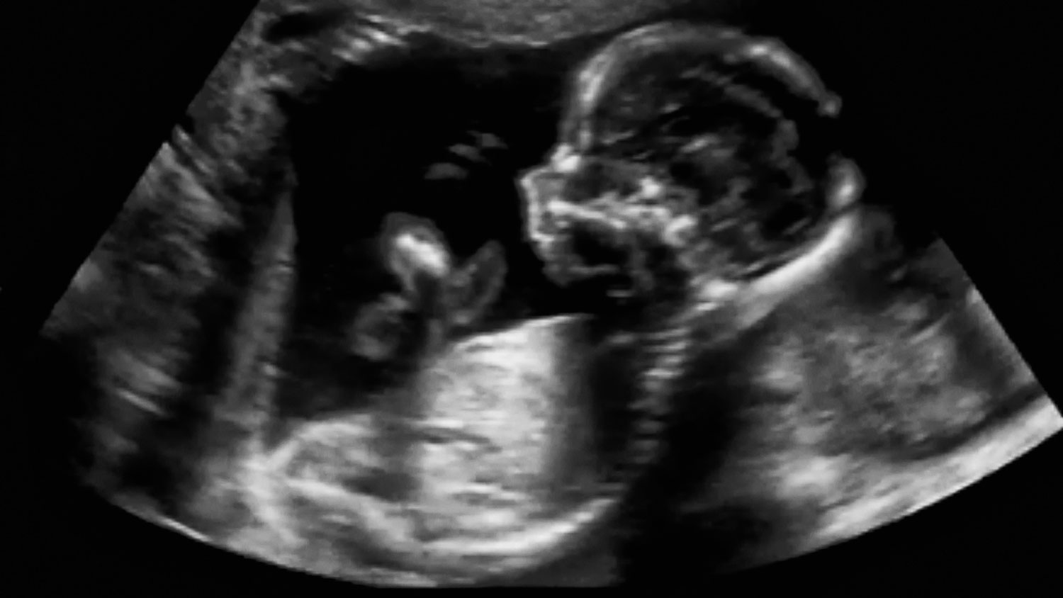 что чувствует ребенок в утробе во время оргазма фото 45