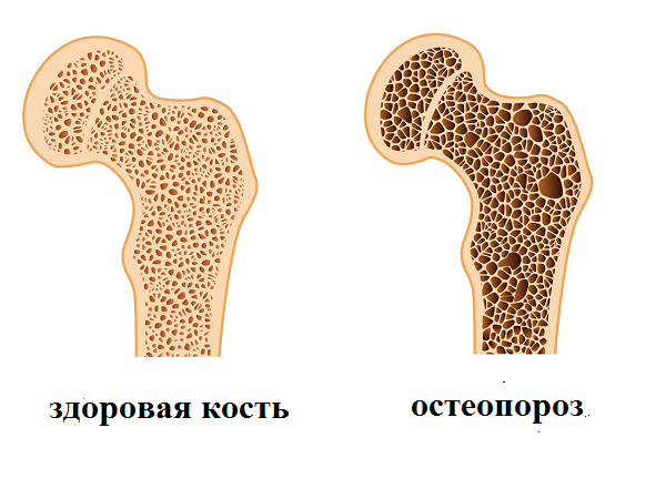 Стать на костях