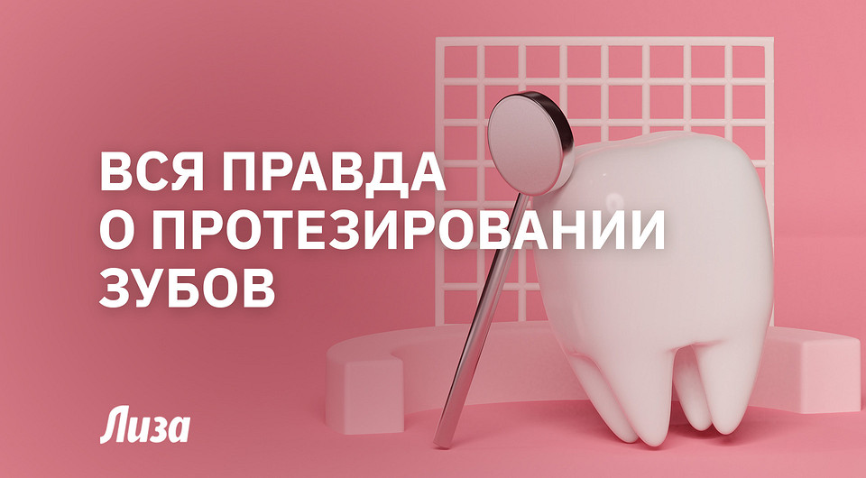 Что выбрать — импланты, виниры или коронки? Стоматолог о протезировании зубов