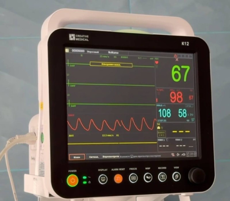 В Кабардино-Балкарии повысился уровень раннего выявления заболеваний и качество диагностики благодаря новому эндоскопическому оборудованию